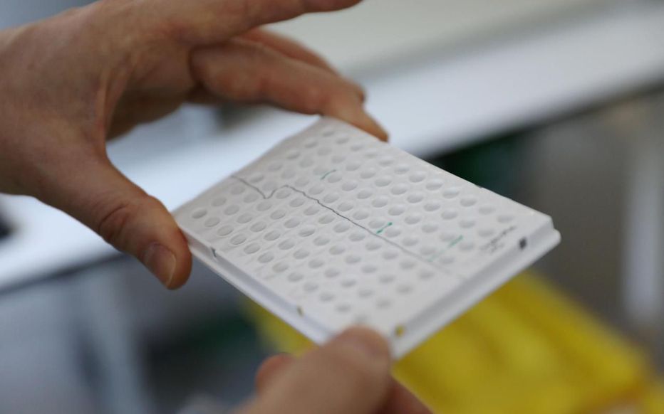 Covid-19 : un test ultrarapide pour détecter le virus