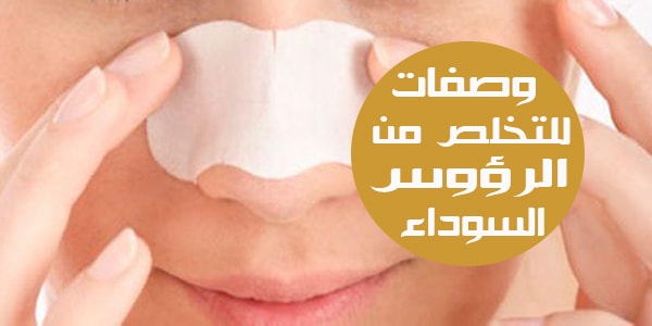 تخلصي من الرؤوس السوداء في يوم واحد.