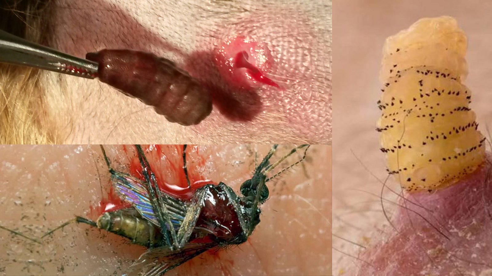 احذروها / ذبابة تبيض في جلد الانسان جاءت من جنوب امريكا…