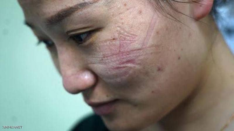 وللكمامات التهابات… وعلى المرأة تجنّب هذه العادة