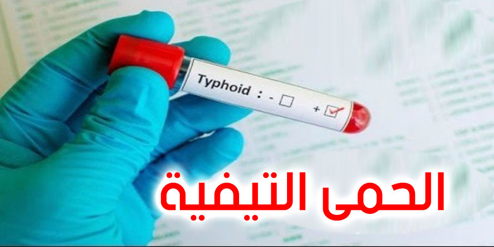 الحمى التيفية تتوسع في ولاية تطاوين