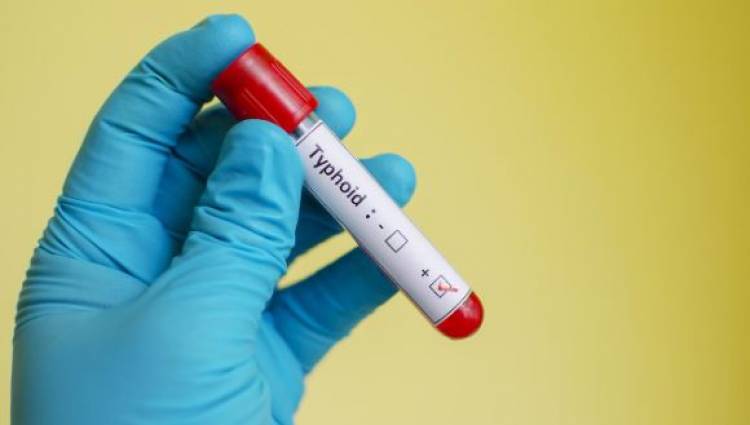 تطاوين: لا خوف على التلاميذ المصابون بالحمّى التيفية