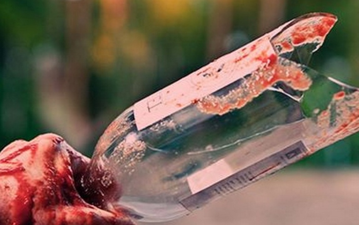 ذبح نديمه بشظيّة زجاجة في هذه المنطقة