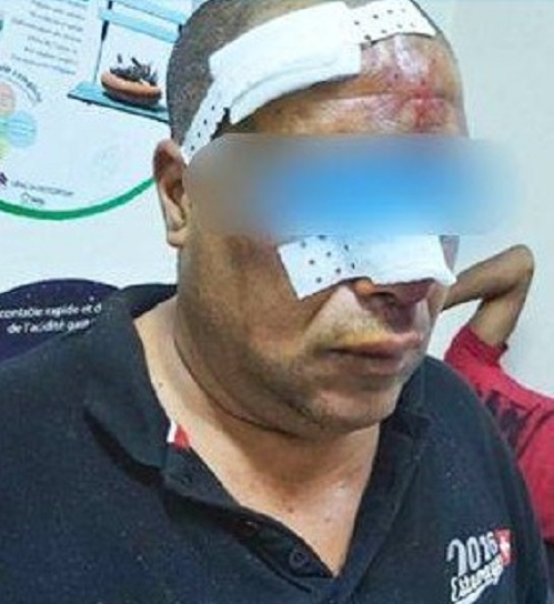 اعتداء على رئيس مكتب الشرطة البيئية بقربة