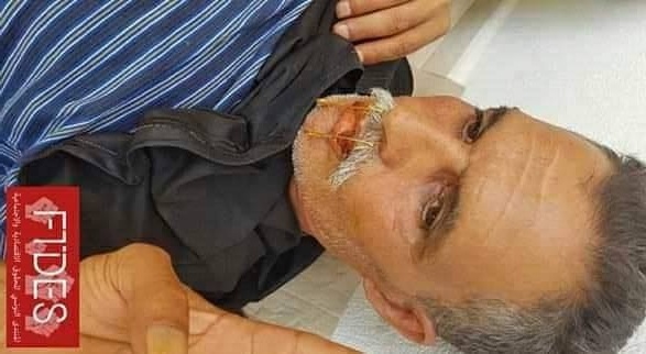 حاجب العيون/ عامل الحضائر يخيط فمه احتجاجا