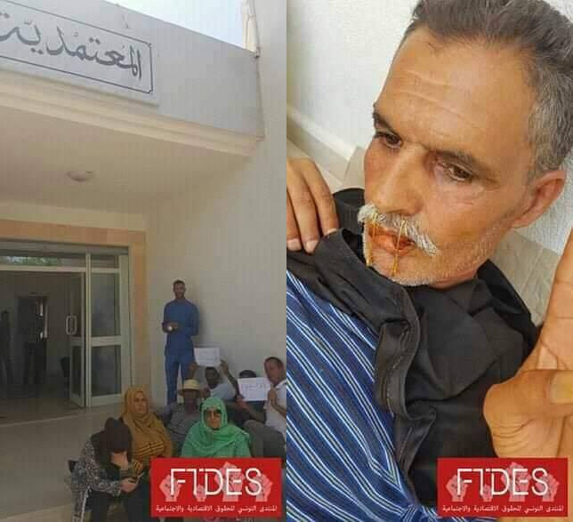 حاجب العيون/ احد عملة الحضائر يخيط فمه احتجاجا