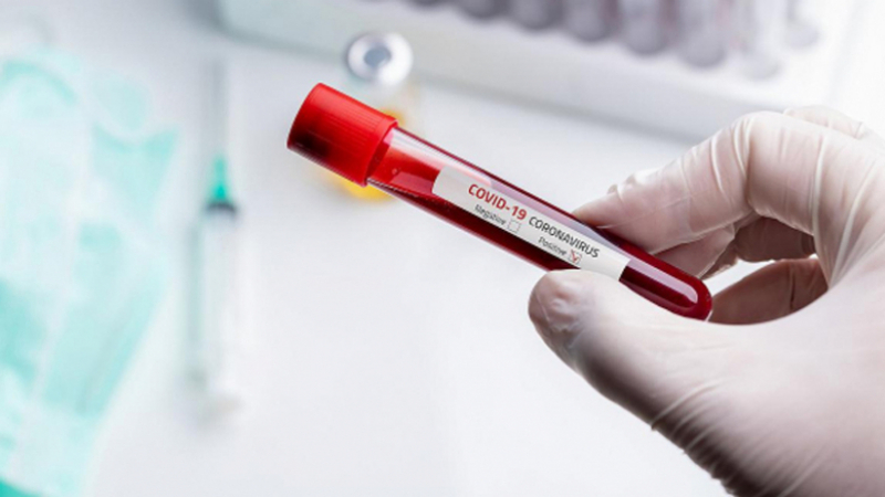 27 اصابة جديدة بكورونا في العاصمة جلها بسبب زفاف الكاف