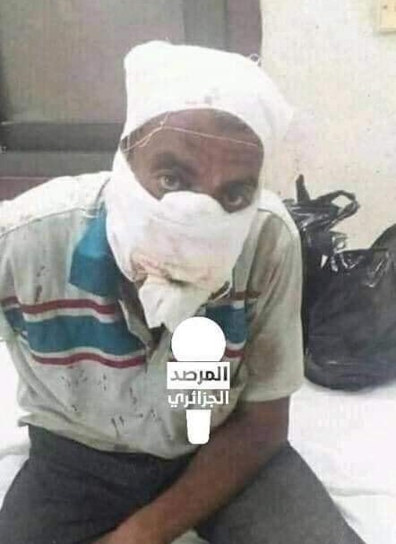 يقطع أنف خاله من أجل الميراث !! (صور و فيديو)