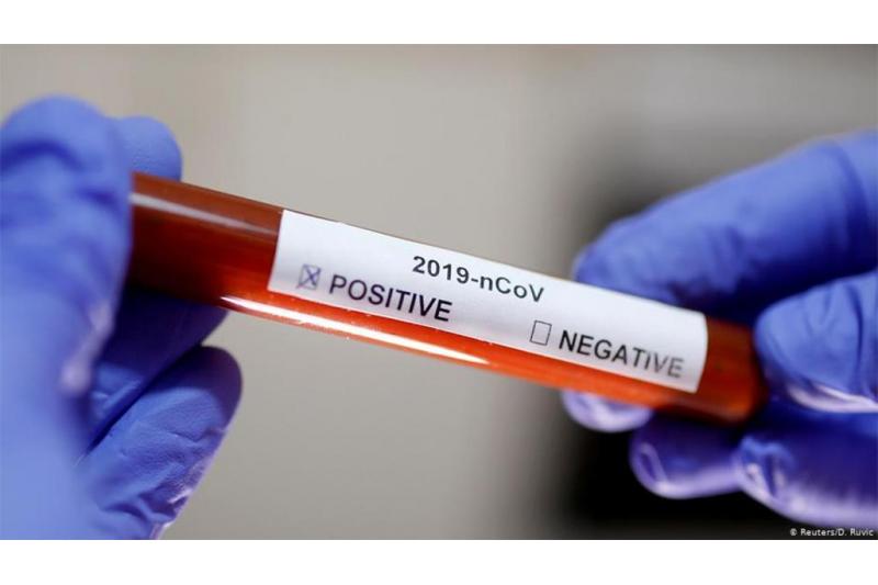 نابل / اصابة طفلة بكورونا بعد إنتقال العدوى إليها من والدتها