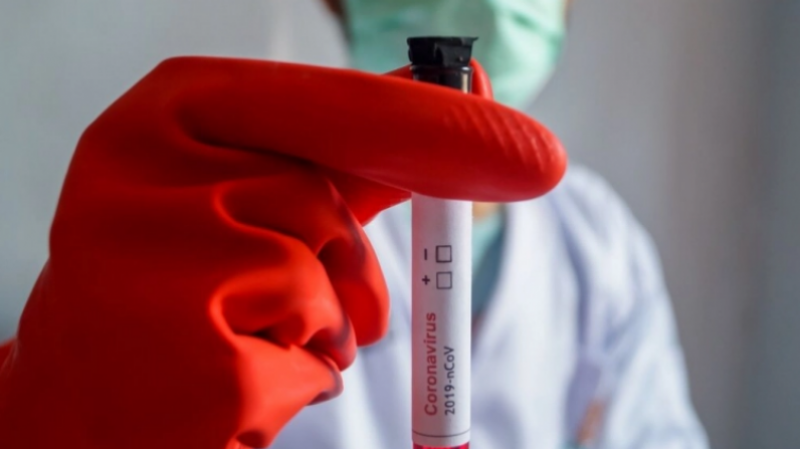 هذا سبب ارتفاع أسعار تحاليل كورونا