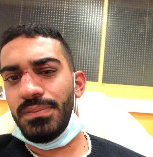 شقيقان يتعرضان للضرب المبرح في فرنسا بسبب لغتهما العربية