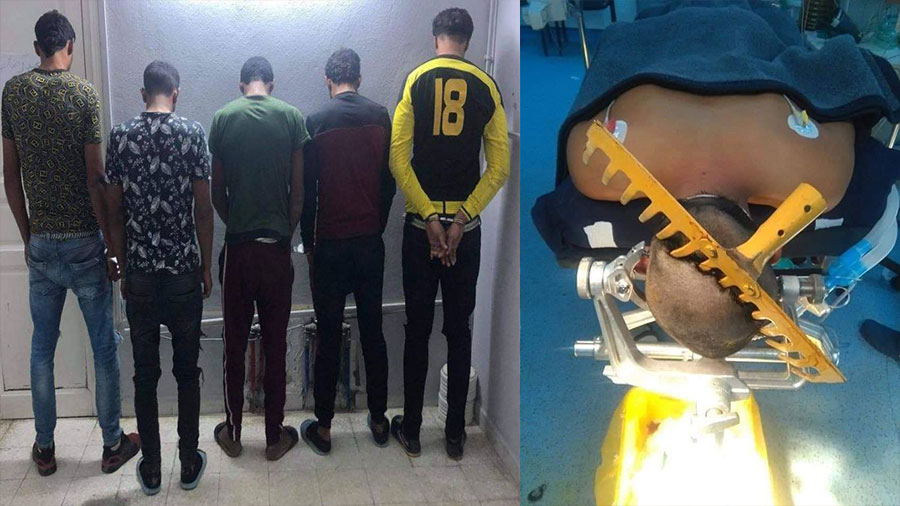 فظيع \طالب باستراجع أمواله فغرسوا أسنان فرشاة في جمجمته