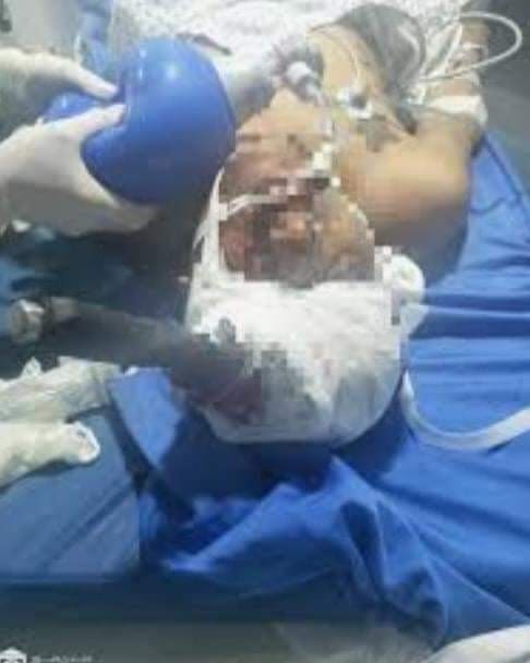 العاصمة: غمسوا آلة حادة في رأسه و تركوه بين الحياة و الموت