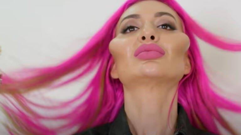 إنها صاحبة أكبر خدود في العالم إنها صاحبة أكبر خدود في العالم