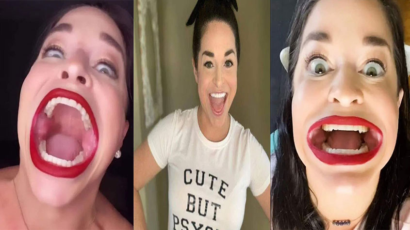 فتاة تمتلك أوسع فتحة فم في العالم فتاة تمتلك أوسع فتحة فم في العالم
