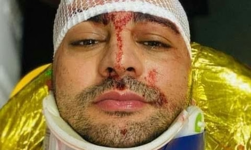 عمار الجمل يتعرض الى إصابة خطيرة