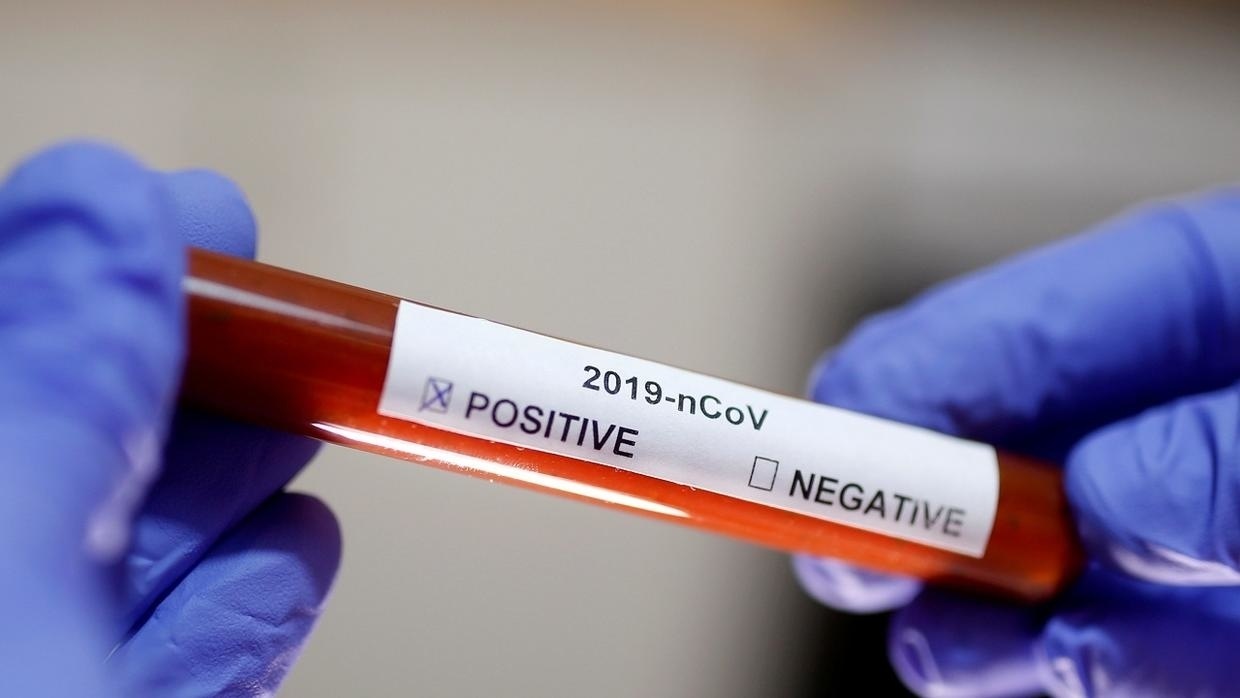 أسرار المناعة من كورونا.. هؤلاء تصعب إصابتهم بالفيروس