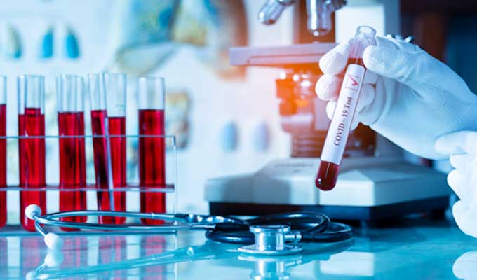 تطاوين: يزوّرون تحاليل كورونا ويبيعونها للمسافرين