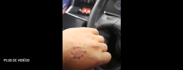 طلب منها سائق الحافلة  ارتداء الكمامة فعضته (فيديو)