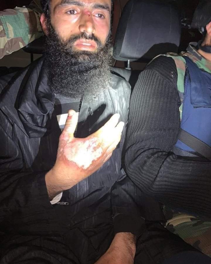 شاهد الفيديو / النار تاكل إرهابي لحظة حرق سيارتي الحرس