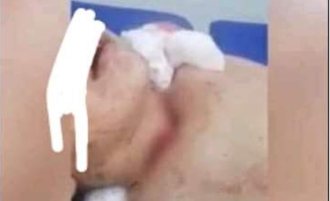 المنستير: طفل الـ 15 سنة يقتل صديقه بقضيب حديدي