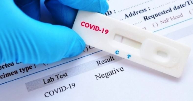 هذا موقف نقابة الصيدليات من سعر التحاليل السريعة