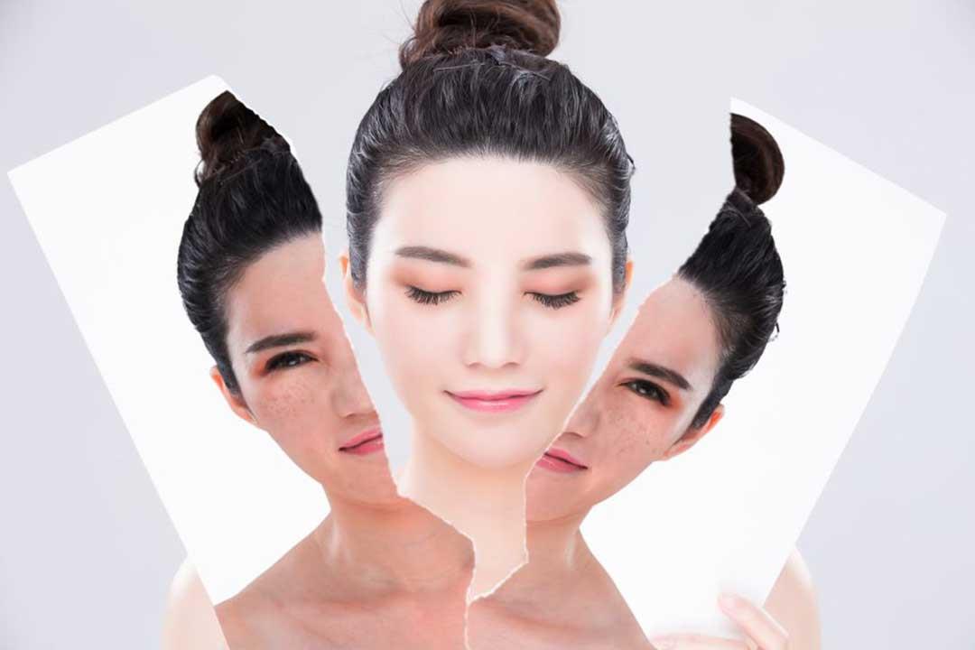 تفتيح البشرة طبيعياً بخلطة سحرية