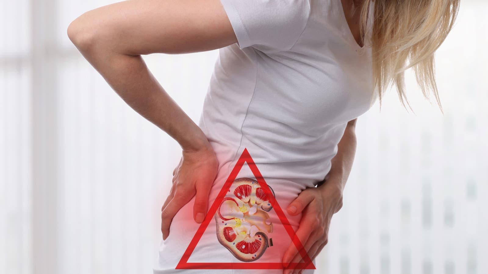 منتجات تؤدي إلى حصوات الكلى منها فيتامين سي