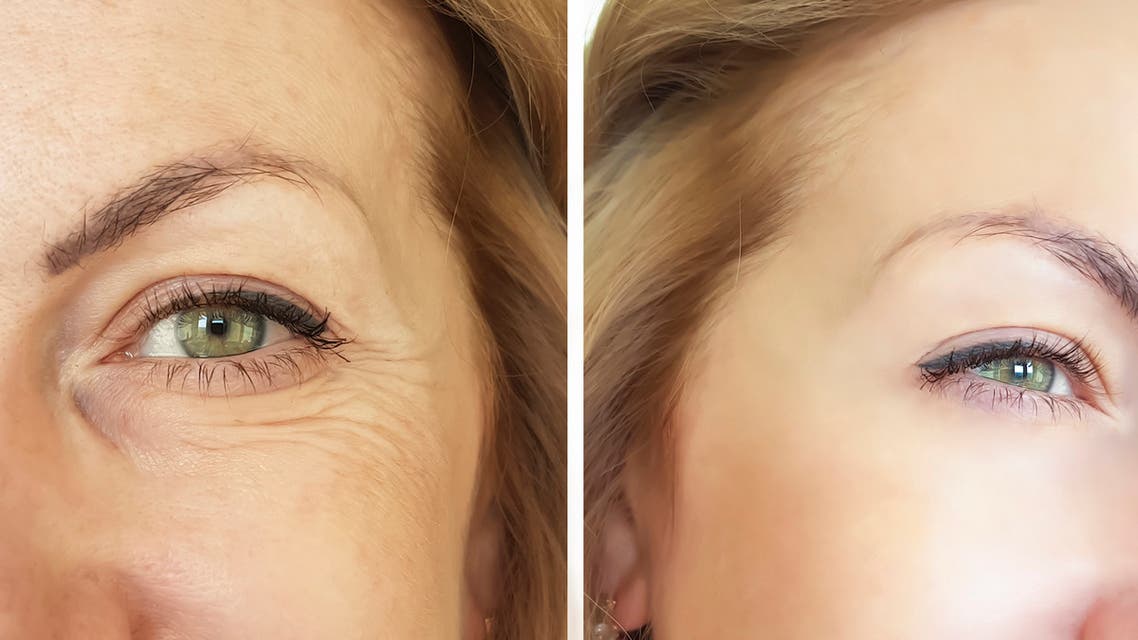 للحصول على بشرة بلا تجاعيد يجب تجنب هذه الأطعمة