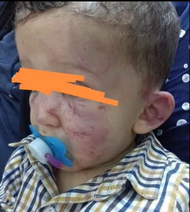 القيروان/ رضيع يتعرض للعنف الشديد في روضة (صور)
