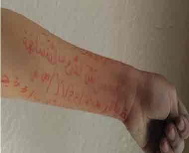 سيدي بوزيد/ معلمة تعاقب تلميذ بكتابة تمرين على يده وعلامة قاطع ومقطوع على وجهه (صور)