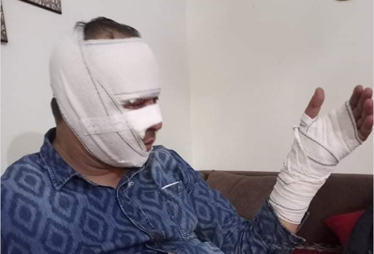 الإطاحة بمفتش عنه تعمّد إضرام النار في أمني الإطاحة بمفتش عنه تعمّد إضرام النار في أمني