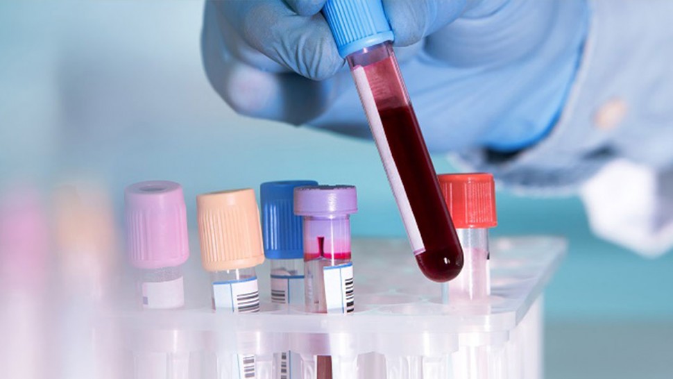 حقنتها إمرأة مجهولة/ نتائج تحاليل طفلة في توزر