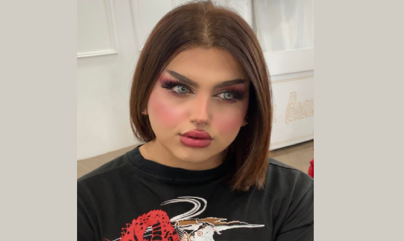 متحوّل جنسيا يلقى حتفه على يد شقيقه