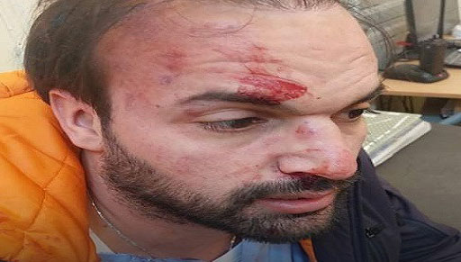 قفصة/ تعنيف طبيب بسبب تأجيل عملية جراحية