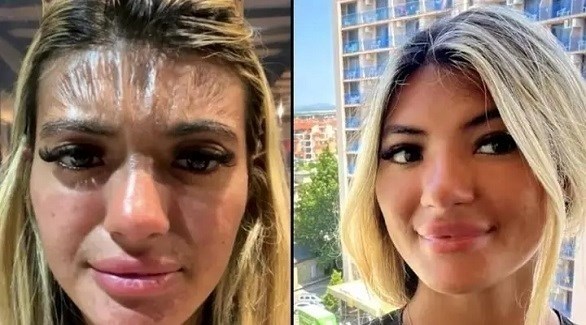 صور/ حرارة الشمس تحوّل جبين شابة إلى قطعة بلاستيك صور/ حرارة الشمس تحوّل جبين شابة إلى قطعة بلاستيك