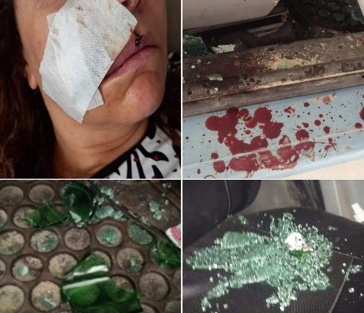 كانت في إجازة بالحمامات/ تعرض عائلة لـ”براكاج” واعتداء بالعنف (صور)