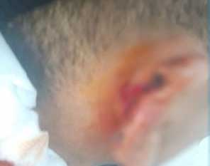 الكبارية/ قضم أذن زميله داخل المعهد