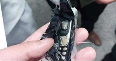 يحدث في مصر/ استخراج هاتف جوال من بطن شاب (صور)