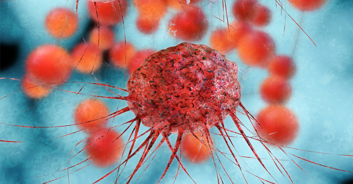 20 ألف إصابة بورم في تونس سنويا