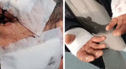 سوسة/ يعتدي على كهل بساطور ويلوذ بالفرار