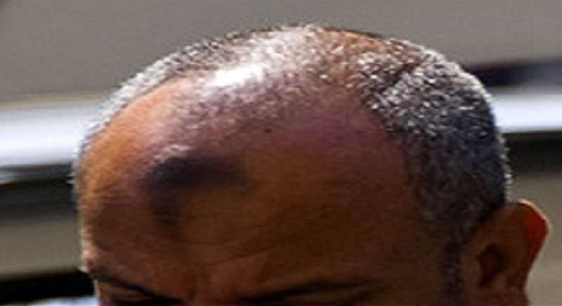 علامات السجود