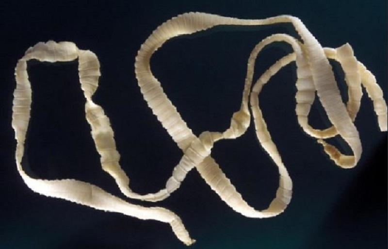 دودة شريطية