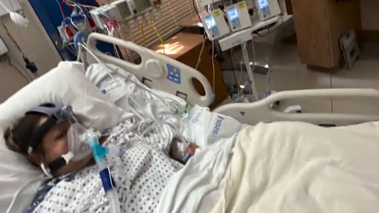 وجبة سمك تسببت في بتر أطراف سيدة !!