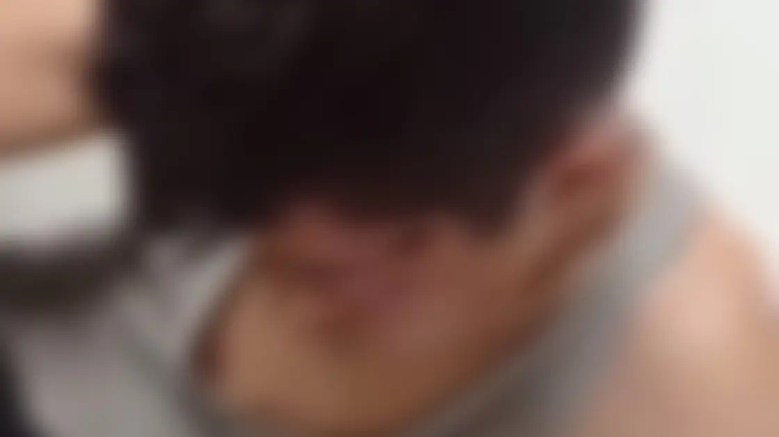 “أحرقوا لسانه ونتفوا شعره”.. تفاصيل تعذيب وحشي لطفل سوري بتركيا