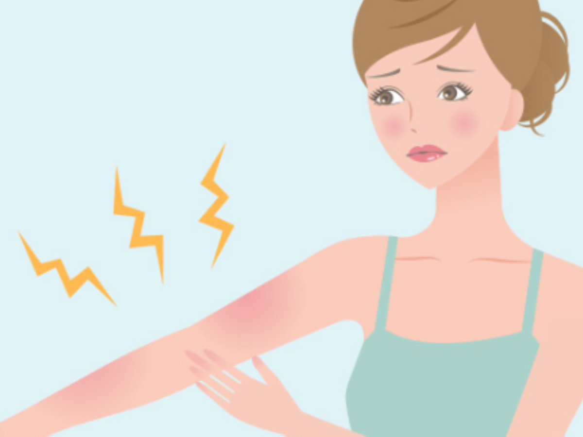 نصائح لمن يعاني من حساسية الشمس