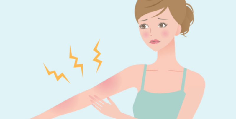 حساسية الشمس