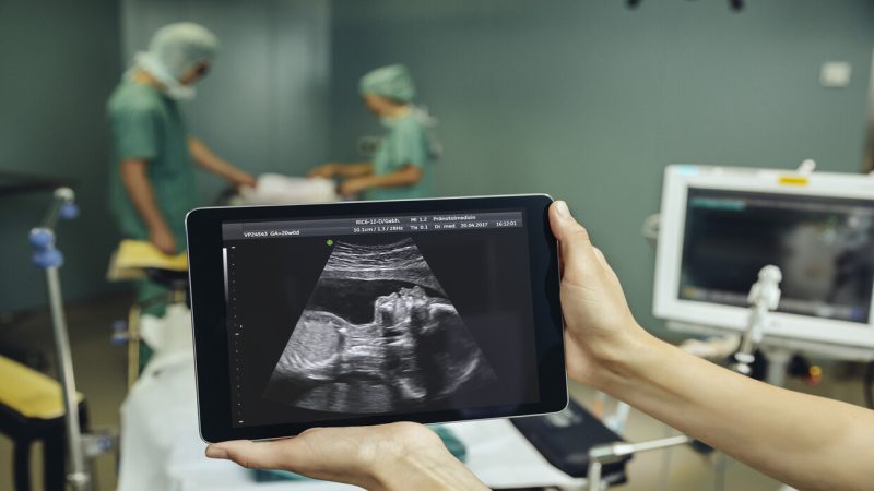 اكتشاف جنين في جمجمة طفلة العام!