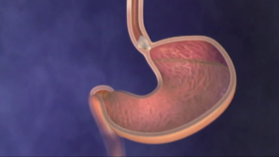 عارض شائع لسرطان العظام ..لا تتجاهله عارض شائع لسرطان العظام ..لا تتجاهله