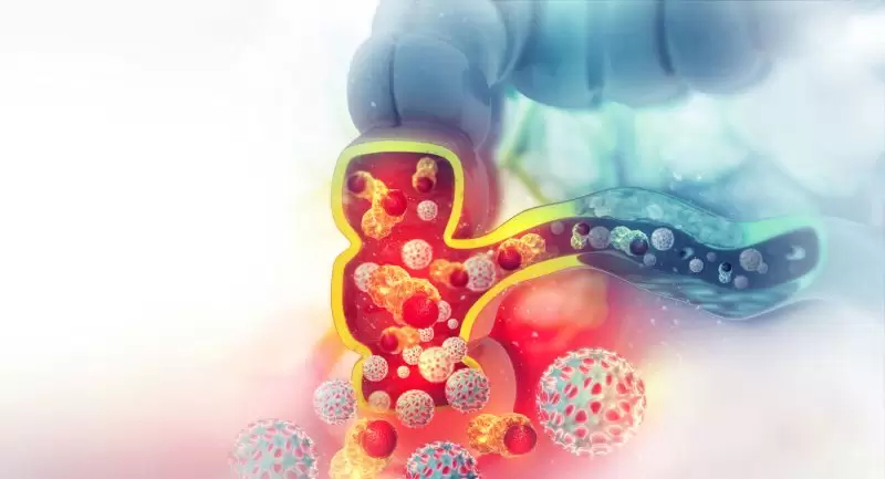 سرطان القولون